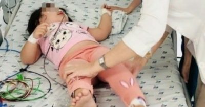 Bé 3 tuổi nhập viện khẩn vì ăn nhầm cơm trộn thuốc diệt chuột